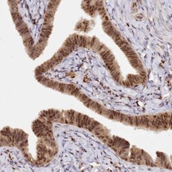 SECISBP2 Antibody, Novus Biologicals:Antibodies:Primary Antibodies